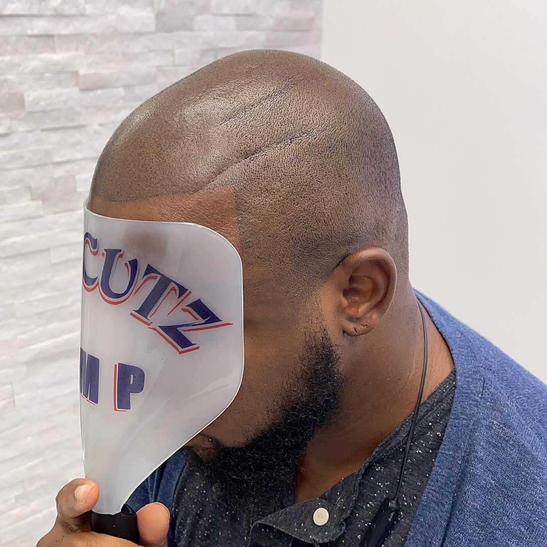 Mr Cutz SMP | Scalp Micropigmentation
