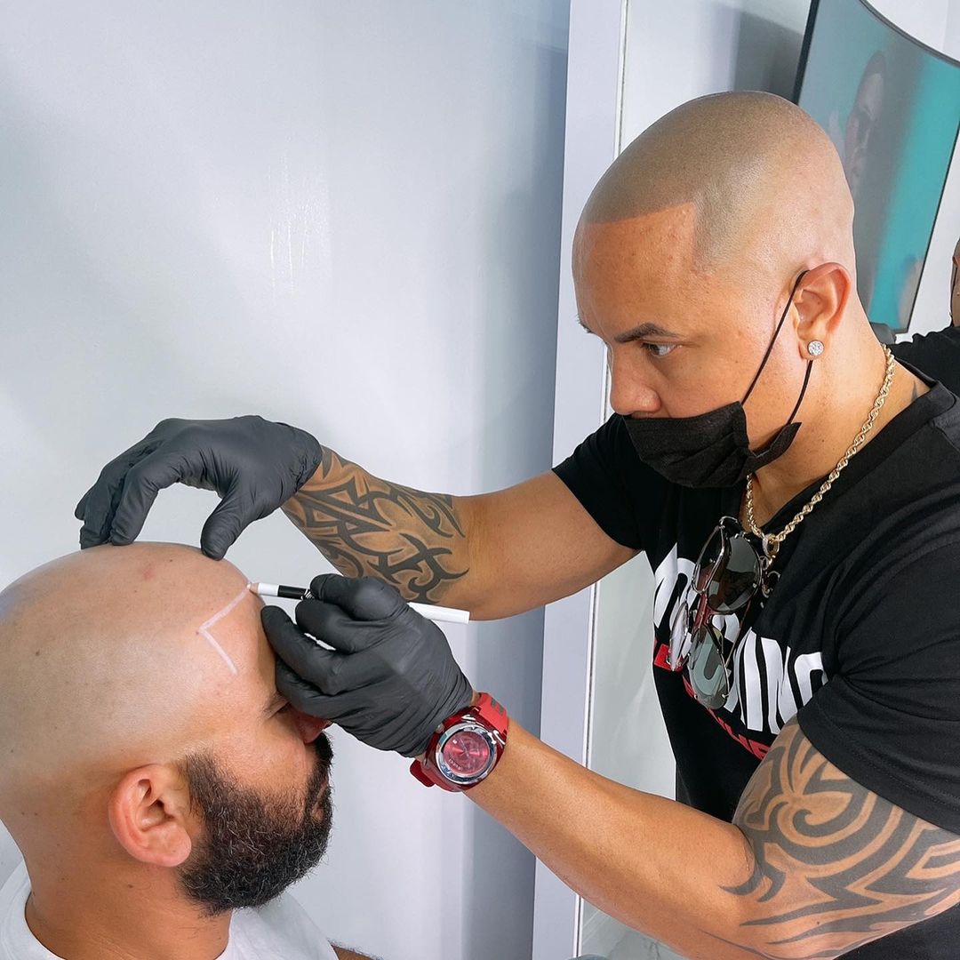 Scalp Micropigmentation Training