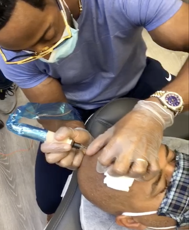 Mr Cutz SMP | Scalp Micropigmentation
